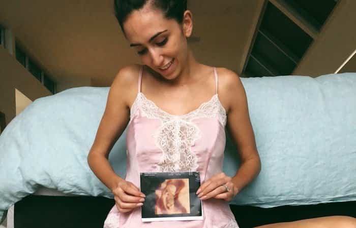 fotos de embarazada con la ecografía en 3D sobre la barriga