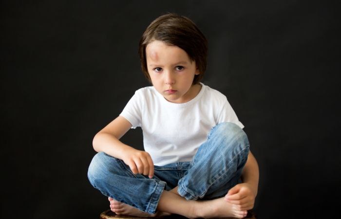 Niño sentado en el suelo con un chichón y cara triste: Consejos de los pediatras para curar los chichones:  pediatras